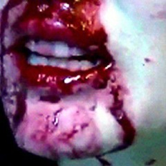 SUICIDAL IDEATION +SIRELLIA [L1GHT]