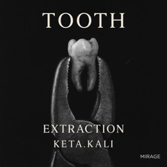 TOOTH - Extraction