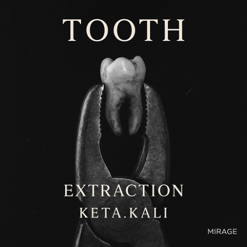 TOOTH - Extraction