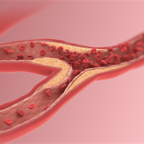 Clear Clogged Arteries_ A Daily Elixir