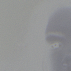 the whites of her eyes.