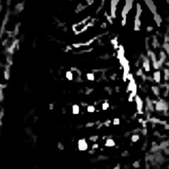 prosopagnosia