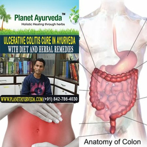 Stream How Ayurveda Medicines Can Help Treat Ulcerative Colitis by