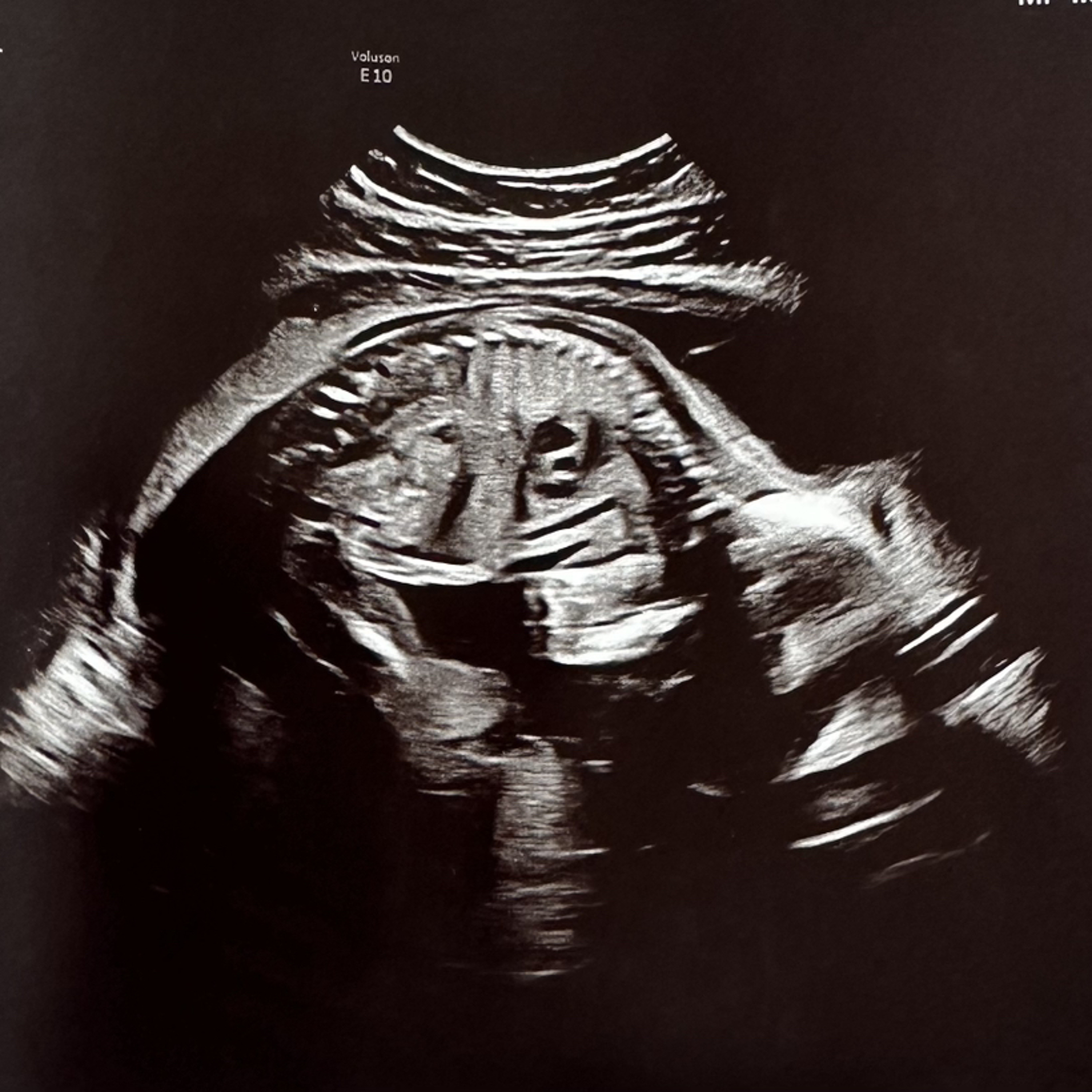 ForLee episode artwork