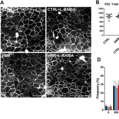 Exercise and L-BAIBA Supplement Boost Muscle and Bone Health in Aging Mice