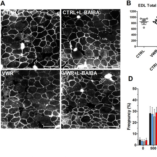 Exercise and L-BAIBA Supplement Boost Muscle and Bone Health in Aging Mice
