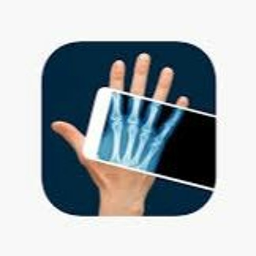 Stream How to Use Camera X Ray to Scan Your Hand and Fool Your Friends