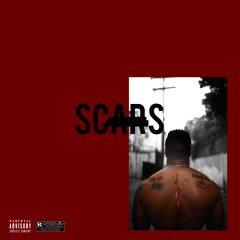 Scars (Prod. by Noizey)