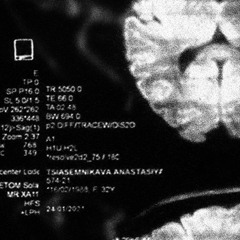 amygdala
