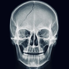 Synkope