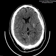 REF TRACK 0001 [2023 - 02 - 07 215706] - CASE IN POINT F