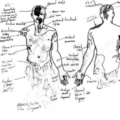 AUTOPSY [January ‎19, ‎2025]