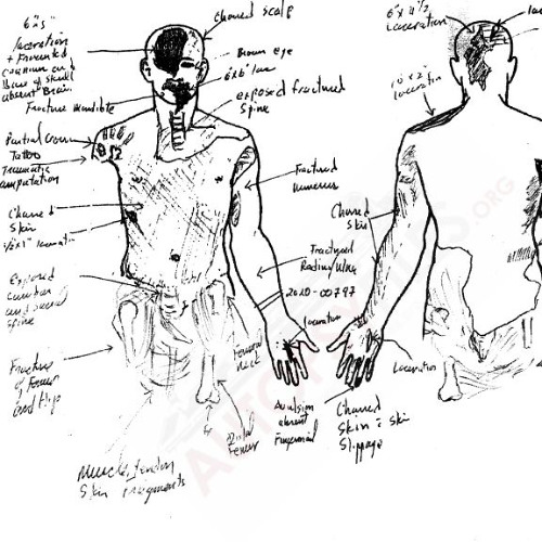 AUTOPSY [January ‎19, ‎2025]