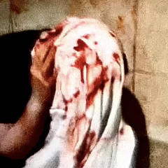 NAPE REMOVAL [PROD. NEXTFRIDAYILLKXLLMYSELF, SLURMORE!!]