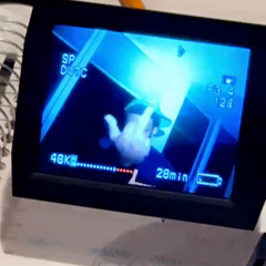 run (yung fazo remix)