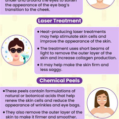 Best Under Eye Bag Treatments Reviews