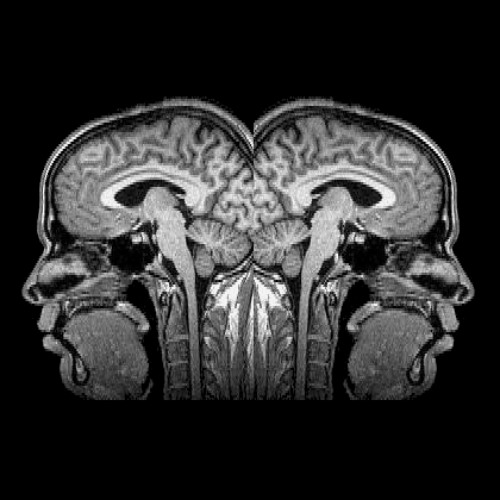 Two Brains - w/ AWITW