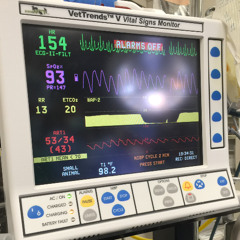 Managing Intra Op Hypotension with Amanda Shelby