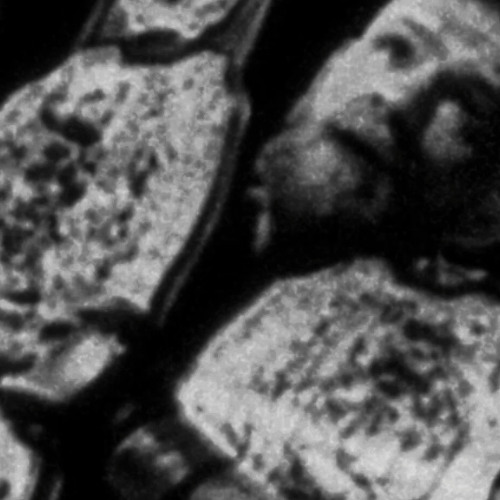 It's in my head 24/7