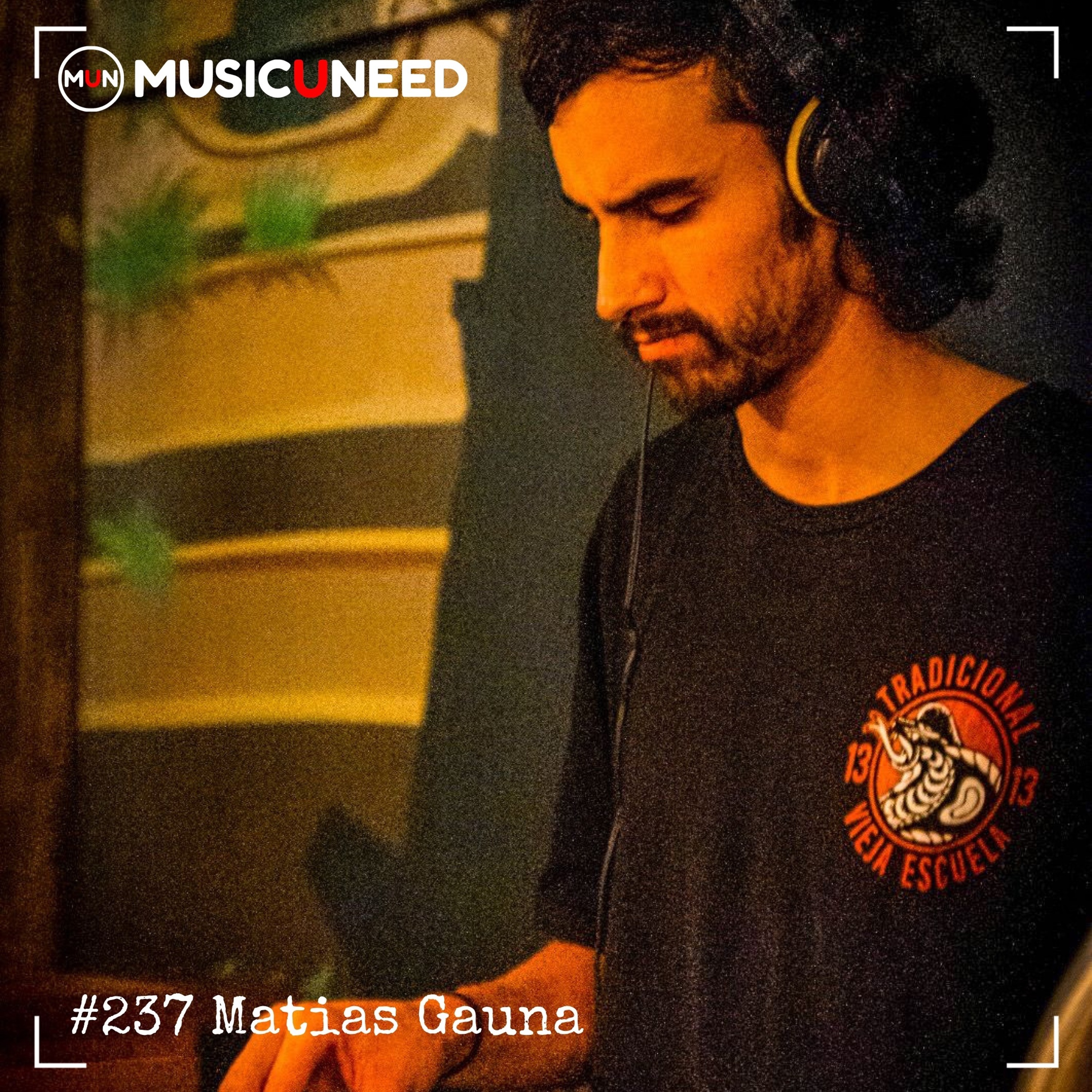 MUSICUNEED