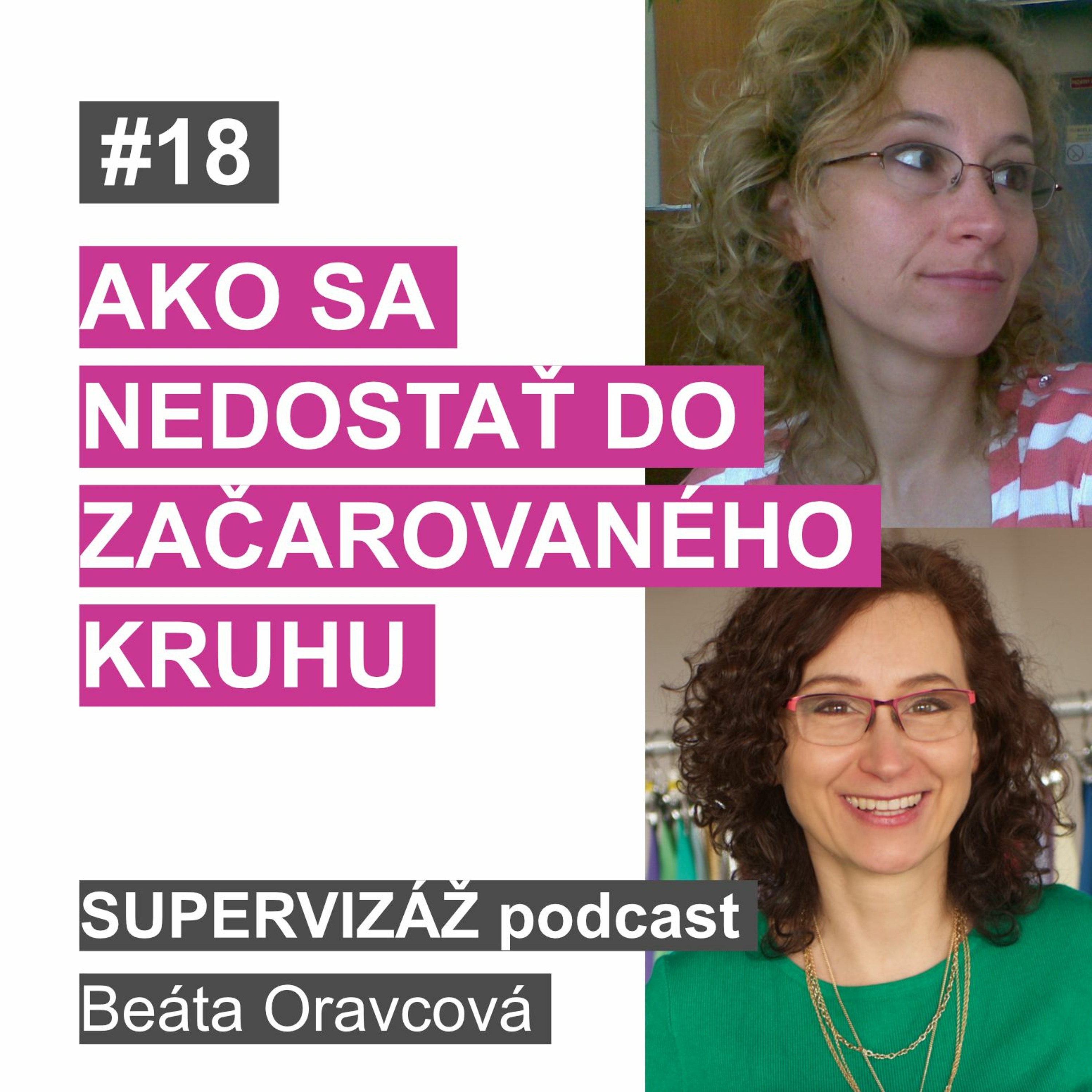 Supervizáž