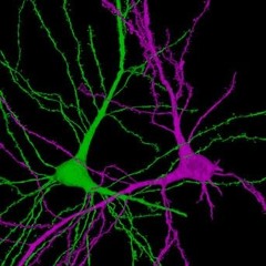 XXXTENTACION YUNG BRATZ REMIX