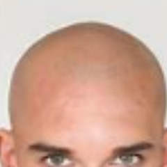 dude why did my mom make my shave my head