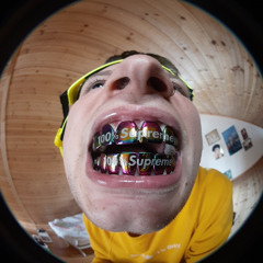 Социофобия