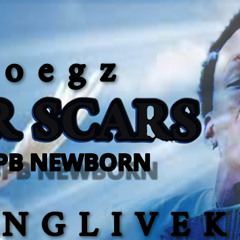 Foegz - War Scars Ft. Spb Newborn