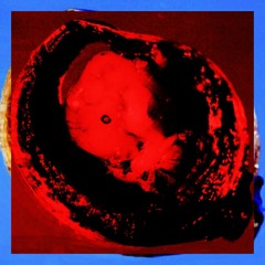 AntiFeticiderMix 003