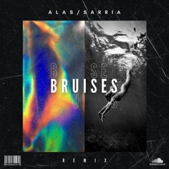 Lewis Capaldi - Bruises (ALAS & SARRIA Remix)