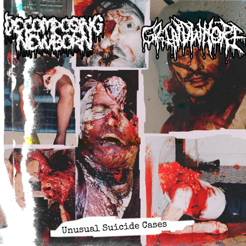 Rearranging The Parts Of The Dismembered Body After A Involuntary Car Accident