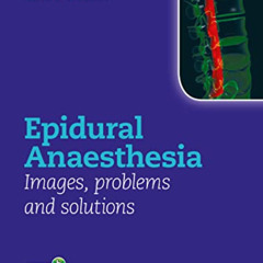 [View] PDF √ Epidural Anaesthesia: Images, Problems and Solutions by  Clive Collier E