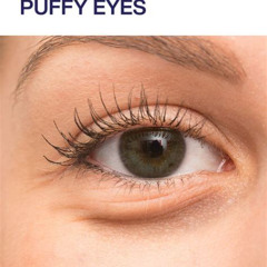 Best Home Treatment For Puffy Eyes Reviews