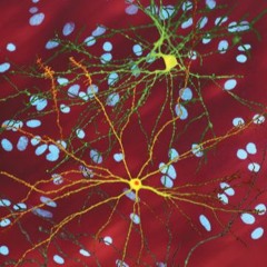 (AFRO ALCANZADO Original) Yormin Fernandez.