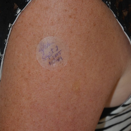 Stream Nitro Patch Placement On Body [REPACK] from Damian Martinez