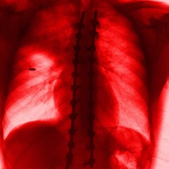 RED BABIES - PURGATORY X SAY10