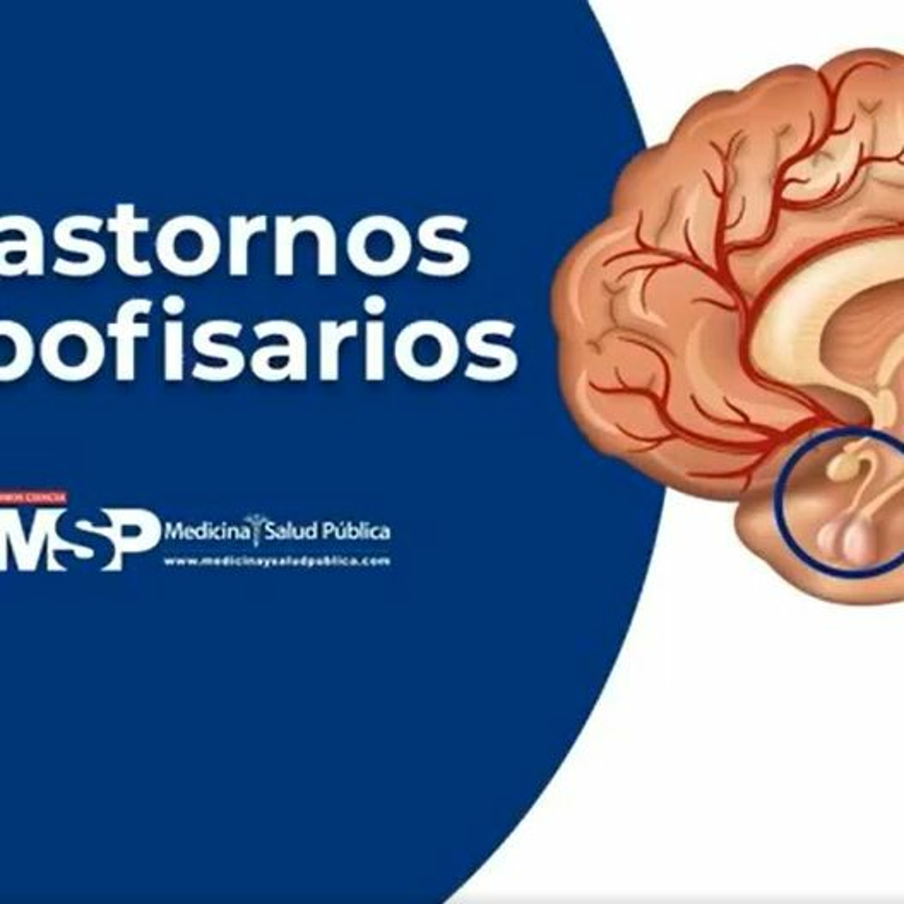 MSP Edición Diaria 17 De Junio
