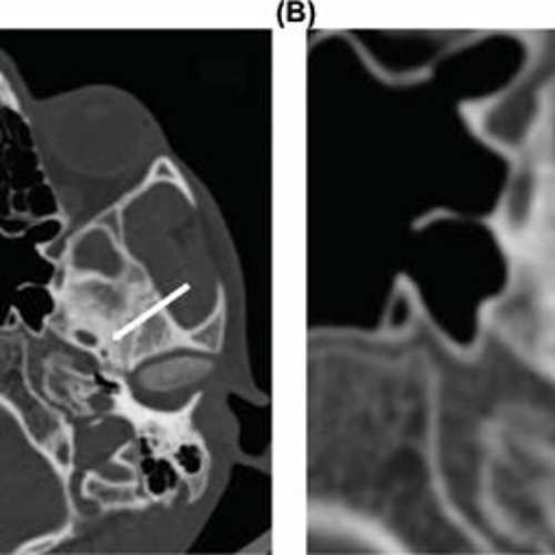 Stream Handbook Of Head And Neck Imaging Harnsberger Pdf 12 from Angela