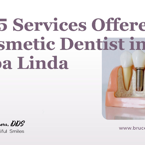 Top 5 Services Offered by a Cosmetic Dentist in Yorba Linda