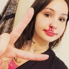 ew ft intend prod @xen