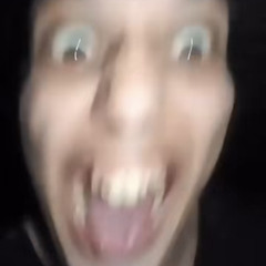 surprise