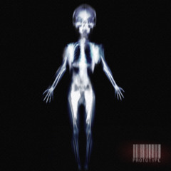 Hybrid Prod.Killvein