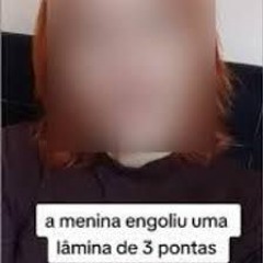 Wacth Video Da Menina Engoliu Lamina De Tres Twitter Trending