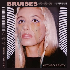 Annika Rose - Bruises (Akimbo Remix)