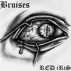 BRUISES