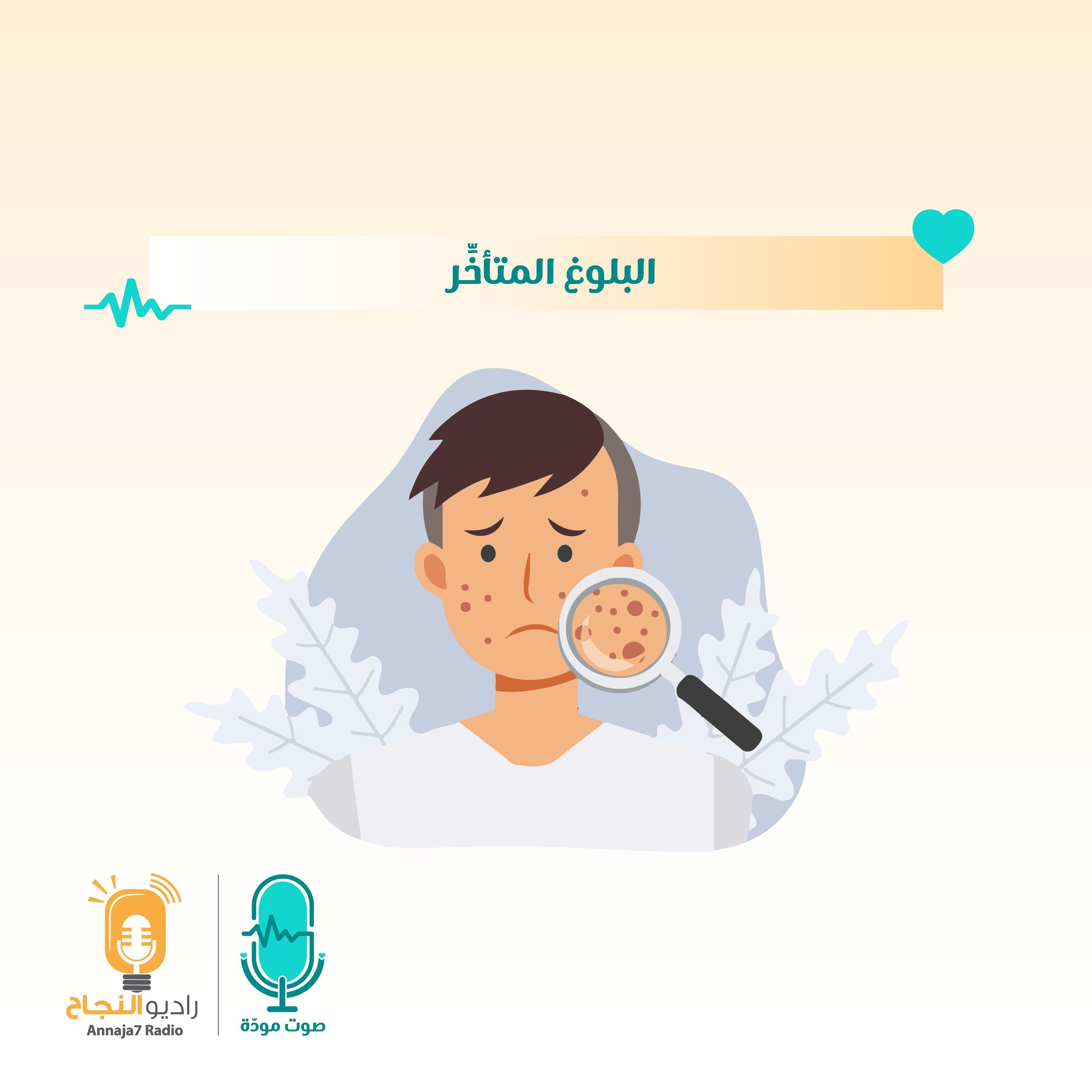 البلوغ المتأخر