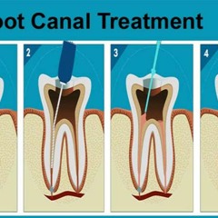 Best Painless Dentistry Treatment in Gurgaon