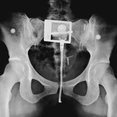 Lorde & 2hollis - Broken Glass [flash remix]