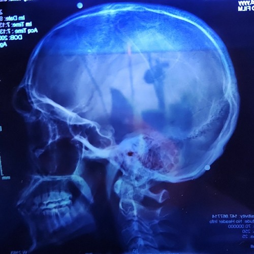 Nauseous (Scrambler) FEAT (Waxy) (CEE$) PROD (LewPon)